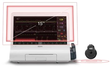 Фетальные мониторы
